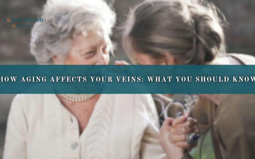How Aging Affects Your Veins: What You Should Know