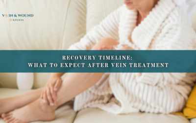 Recovery Timeline: What to Expect After Vein Treatment