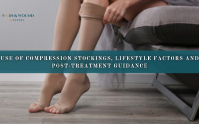 Use of compression stockings, lifestyle factors and post-treatment guidance