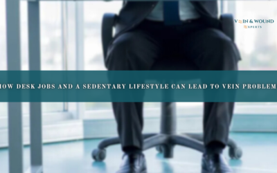 How Desk Jobs and a Sedentary Lifestyle Can Lead to Vein Problems