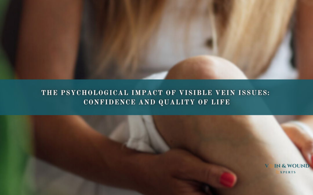 The Psychological Impact of Visible Vein Issues