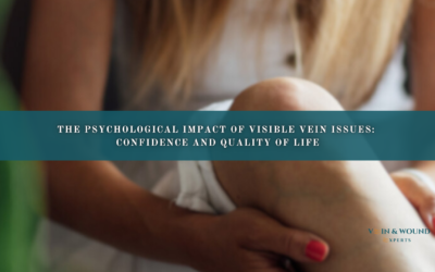 The Psychological Impact of Visible Vein Issues