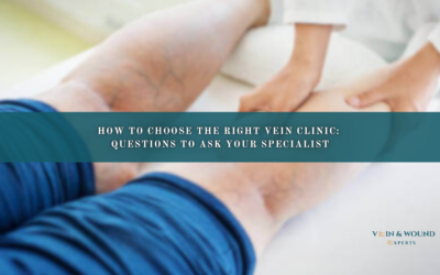 How to Choose the Right Vein Clinic: Questions to Ask Your Specialist
