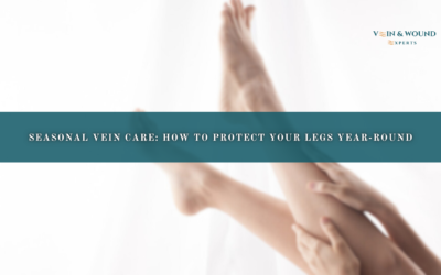 Seasonal Vein Care: How to Protect Your Legs Year-Round