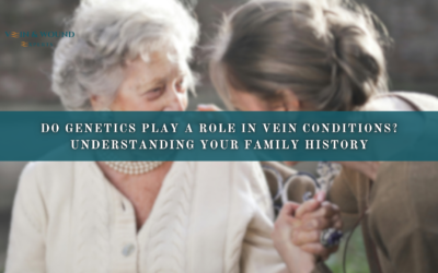 Do Genetics Play a Role in Vein Conditions? Understanding Your Family History