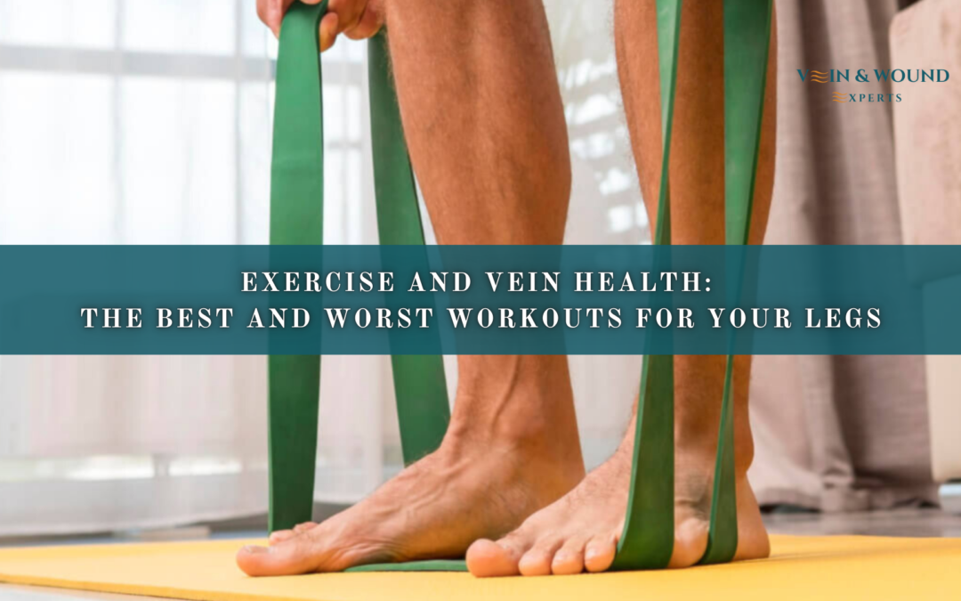 Exercise and Vein Health: The Best and Worst Workouts for Your Legs