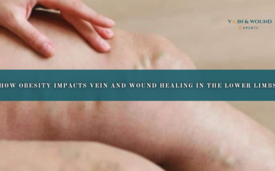 How Obesity Impacts Vein and Wound Healing in the Lower Limbs