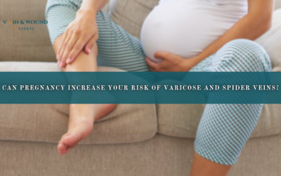 Can Pregnancy Increase Your Risk of Varicose and Spider Veins?