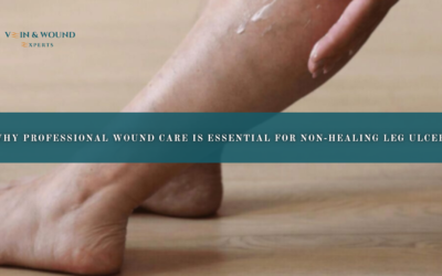 Why Professional Wound Care Is Essential for Non-Healing Leg Ulcers