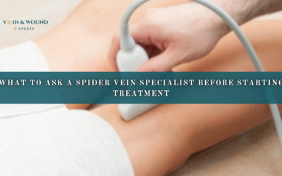 What to Ask a Spider Vein Specialist Before Starting Treatment