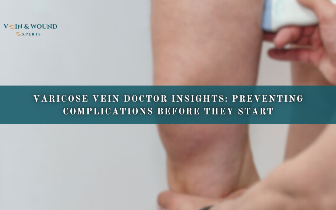 Varicose Vein Doctor Insights: Preventing Complications Before They Start