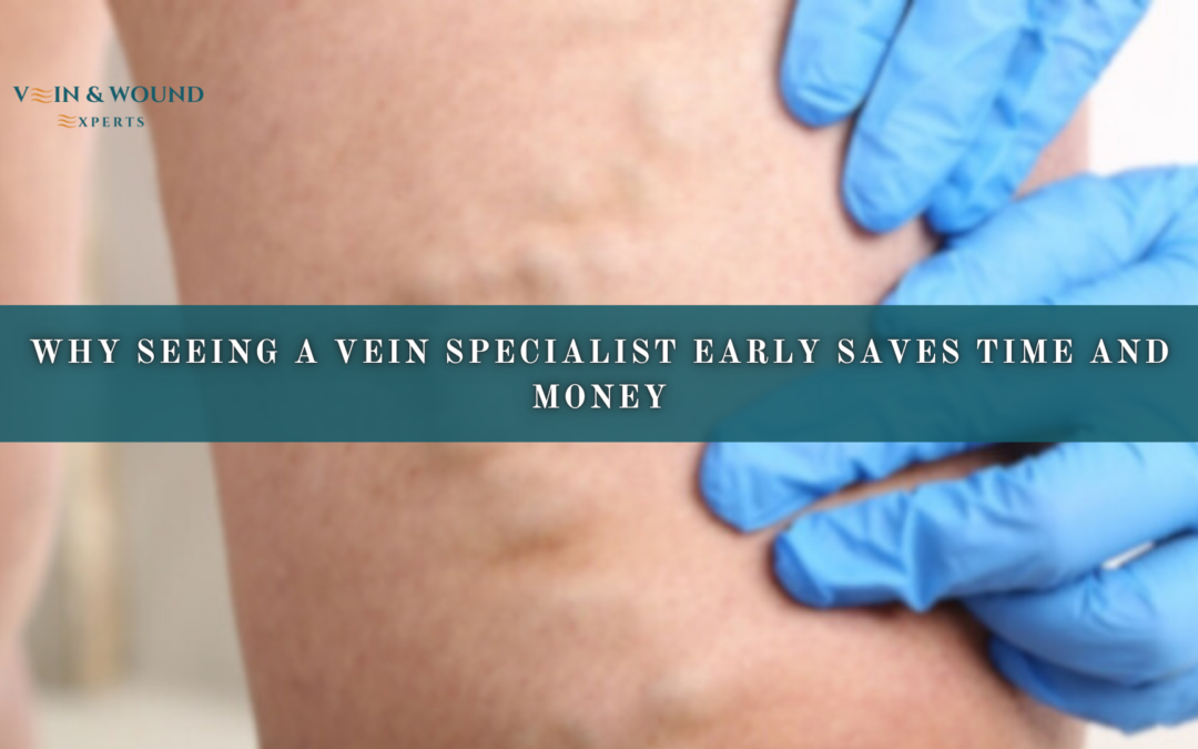 Why Seeing a Vein Specialist Early Saves Time and Money
