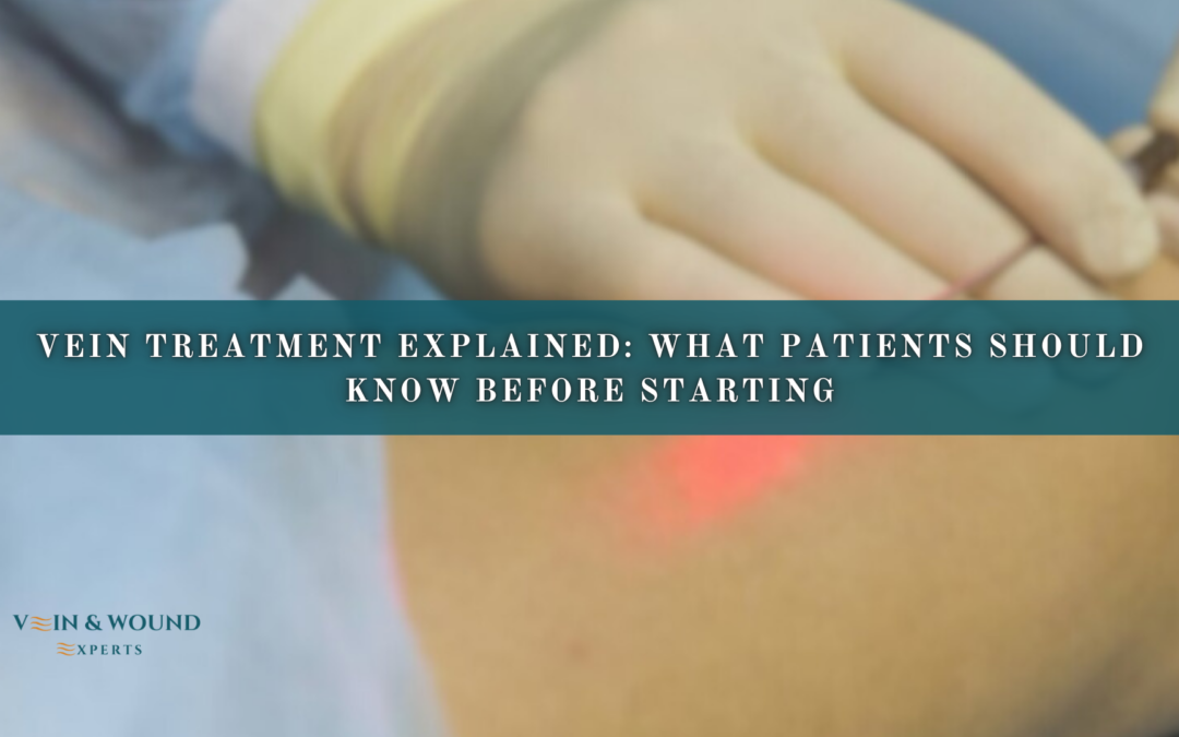 Vein Treatment Explained: What Patients Should Know Before Starting