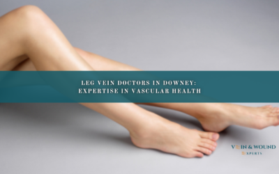 Leg Vein Doctors in Downey: Expertise in Vascular Health