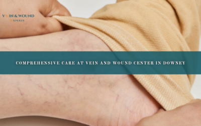 Comprehensive Care at Vein and Wound Center in Downey