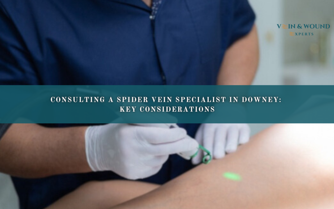 Consulting a Spider Vein Specialist in Downey: Key Considerations