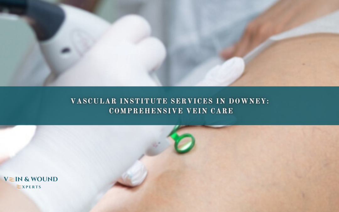 Vascular Institute Services in Downey: Comprehensive Vein Care