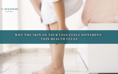 Why the Skin on Your Legs Feels Different: Vein Health Clues