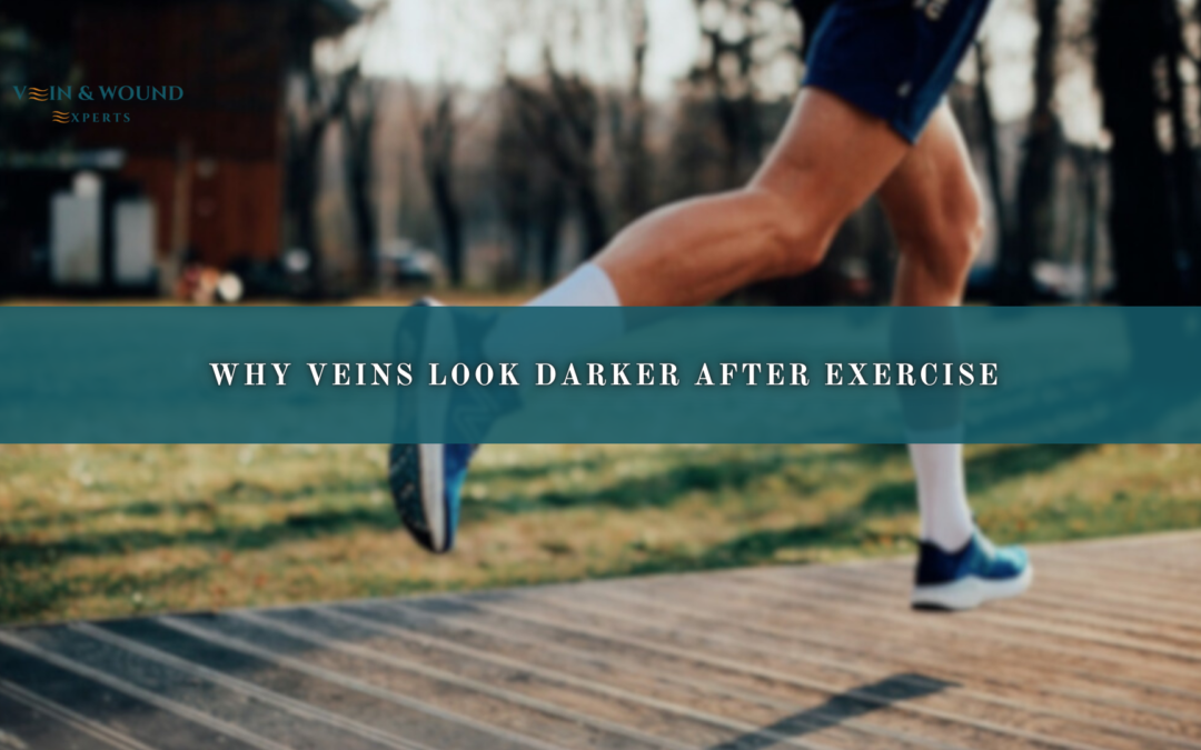 Why Veins Look Darker After Exercise