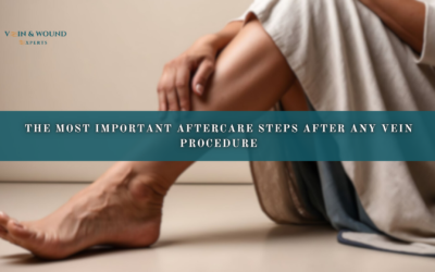 The Most Important Aftercare Steps After Any Vein Procedure