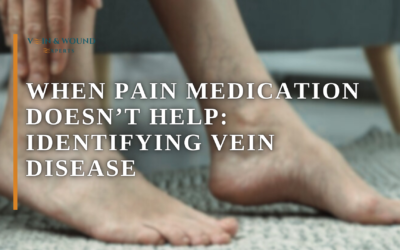 When Pain Medication Doesn’t Help: Identifying Vein Disease