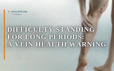 Difficulty Standing for Long Periods: A Vein Health Warning
