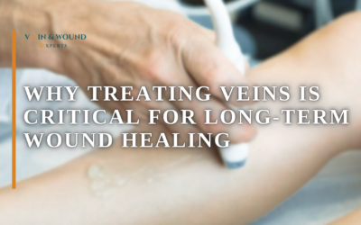 Why Treating Veins Is Critical for Long-Term Wound Healing