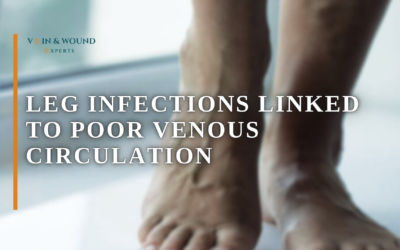 Leg Infections Linked to Poor Venous Circulation