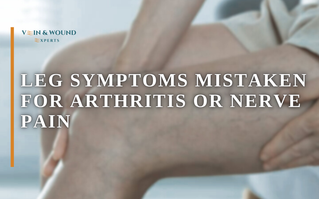 Leg Symptoms Mistaken for Arthritis or Nerve Pain