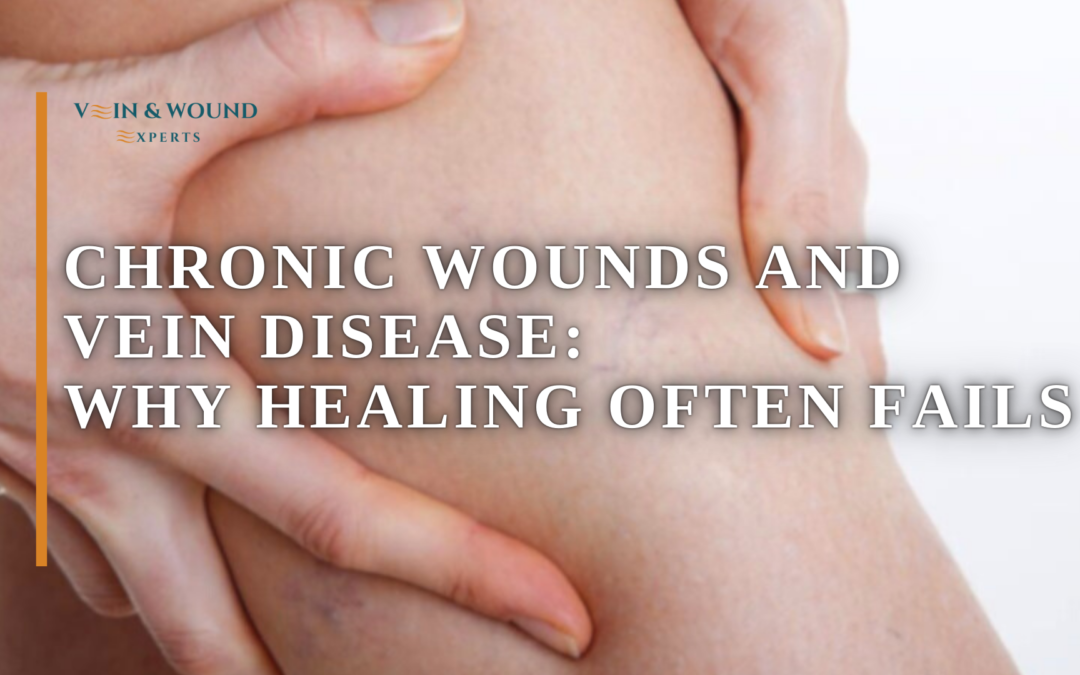 Chronic Wounds and Vein Disease: Why Healing Often Fails