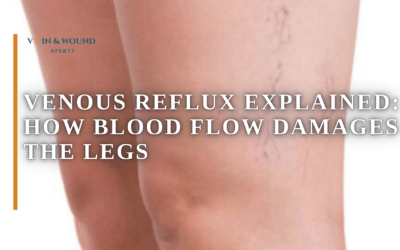 Venous Reflux Explained: How Blood Flow Damages the Legs