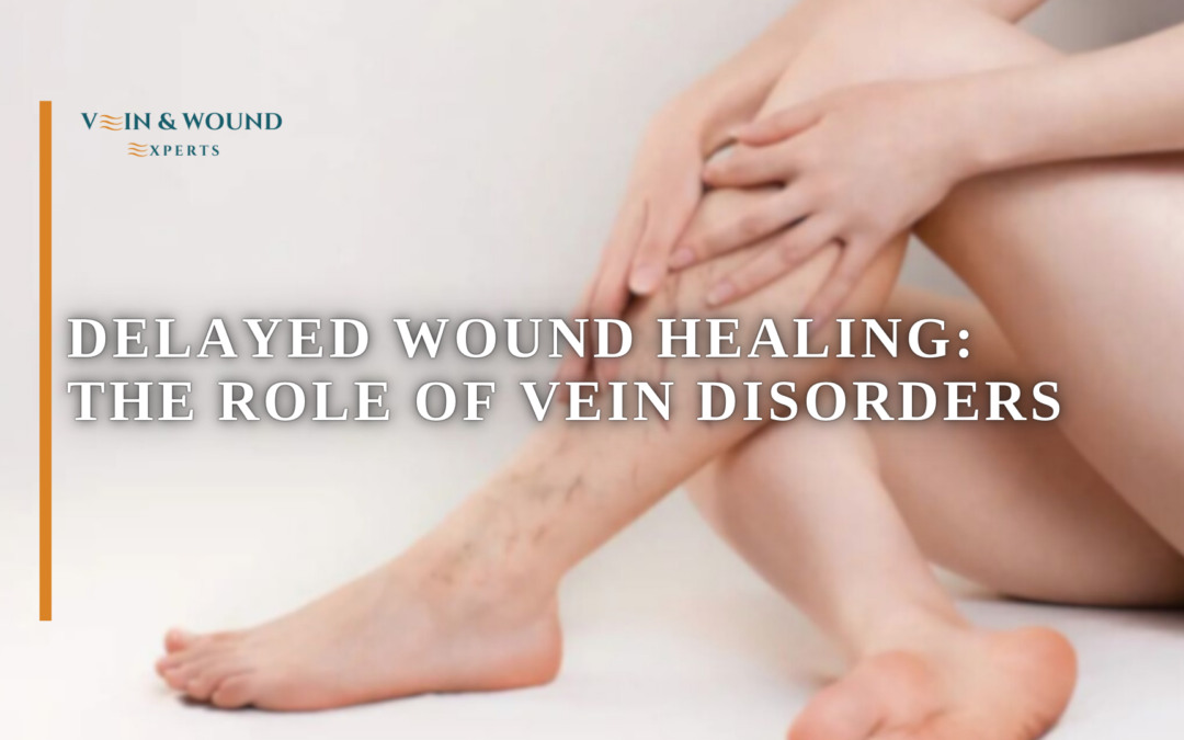 Delayed Wound Healing: The Role of Vein Disorders