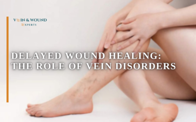 Delayed Wound Healing: The Role of Vein Disorders
