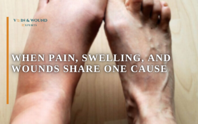 When Pain, Swelling, and Wounds Share One Cause
