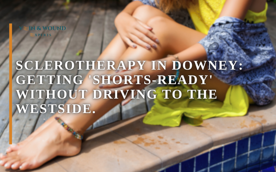 Sclerotherapy in Downey: Getting ‘Shorts-Ready’ Without Driving to the Westside.