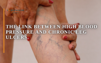 The Link Between High Blood Pressure and Chronic Leg Ulcers