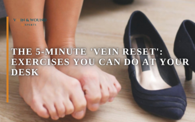 The 5-Minute ‘Vein Reset’: Exercises You Can Do at Your Desk