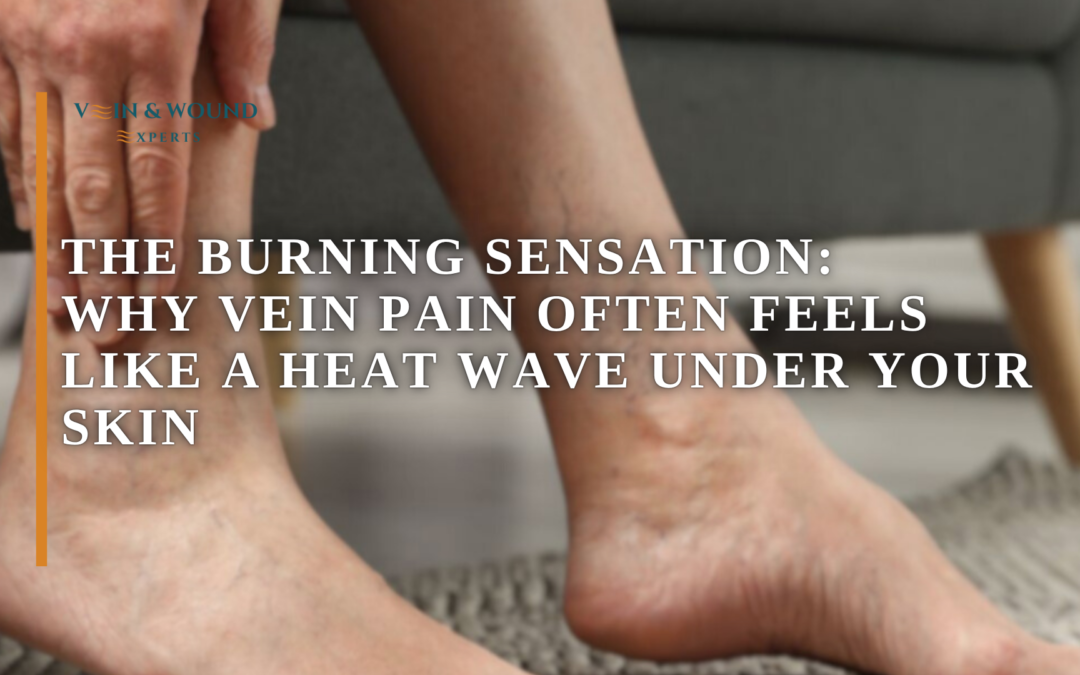 The Burning Sensation: Why Vein Pain Often Feels Like a Heat Wave Under Your Skin