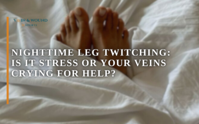 Nighttime Leg Twitching: Is It Stress or Your Veins Crying for Help?