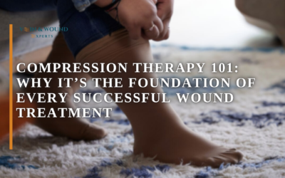 Compression Therapy 101: Why It’s the Foundation of Every Successful Wound Treatment