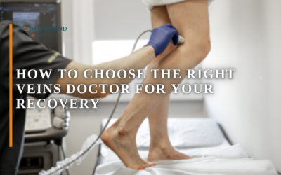 How to Choose the Right Veins Doctor for Your Recovery