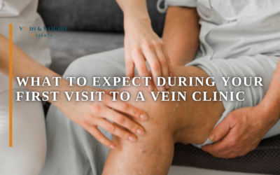What to Expect During Your First Visit to a Vein Clinic