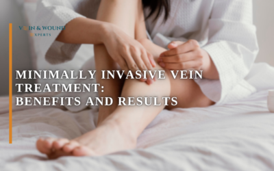 Minimally Invasive Vein Treatment: Benefits and Results