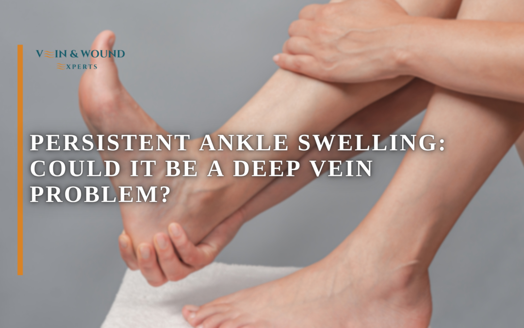 Persistent Ankle Swelling: Could It Be a Deep Vein Problem?