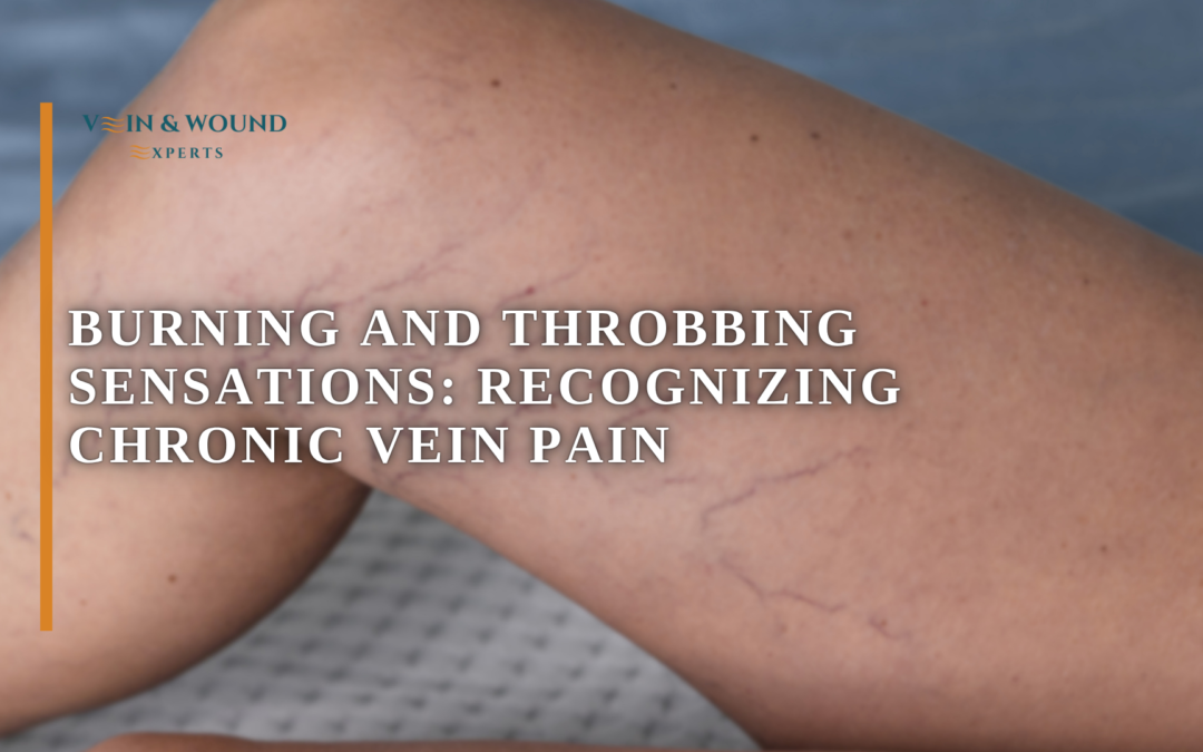 Burning and Throbbing Sensations: Recognizing Chronic Vein Pain