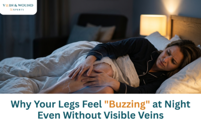 Why Your Legs Feel “Buzzing” at Night Even Without Visible Veins