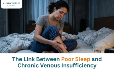 The Link Between Poor Sleep and Chronic Venous Insufficiency