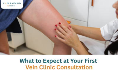 What to Expect at Your First Vein Clinic Consultation