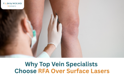 Why Top Vein Specialists Choose RFA Over Surface Lasers