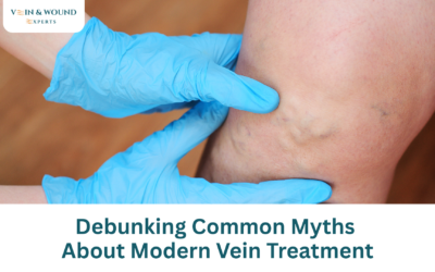 Debunking Common Myths About Modern Vein Treatment